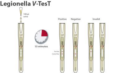 lub ELISA (poziom przeciwciał narasta powoli, dlatego test ten stosowany jest najczęściej do celów epidemiologicznych) antygeny Legionella pneumophila serotypu 1 w moczu, brak ich wykrycia przy