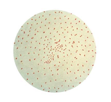 Diagnostyka Bordatella pertussis badanie mikrobiologiczne badanie plwociny,