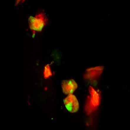 TESTY IMMUNOFLUORESCENCYJNE Antygenów wirusowych w