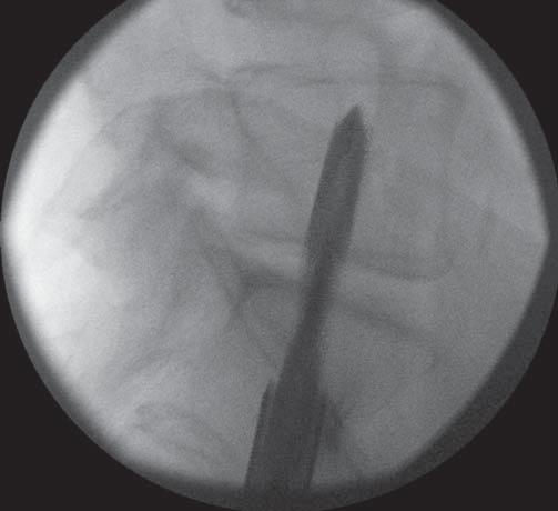fluoroskopii (b).
