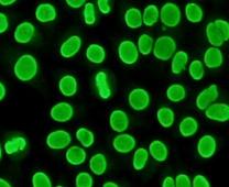 [ 100 ] Podstawy immunologii dla reumatologów 4. Typy świecenia jądra komórkowego 4.1. Homogenny typ świecenia Ryc. 2.
