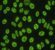 Taki typ świecenia dają przeciwciała skierowane przeciw antygenom związanym z chromatyną: DNA, histonom i nukleosomom.