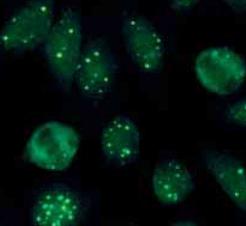 [ 102 ] Podstawy immunologii dla reumatologów Ryc. 7. Typ świecenia nuclear dots w interfazowym jądrze świeci od 1 do 6 kropek. Antygenami są białka SMN i p80-koilina.