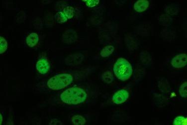 DIAGNOSTYKA LABORATORYJNA AUTOPRZECIWCIAŁ... [ 103 ] Ryc. 9. Tp świecenia PCNA Ryc. 10. Typ świecenia CENP- F 4.8. Świecenie przeciwciał dla antygenu Scl-70 (DNA topoizomeraza I) Ryc. 11.