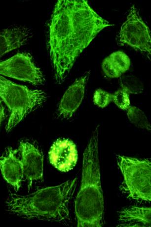 mitochondrion like) typ świecenia Wzór świecenia opisywany często jako gruboplamisty, ziarnistości są