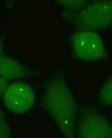[ 106 ] Podstawy immunologii dla reumatologów Głównym antygenem dla przeciwciał dających ten typ świecenia jest enzym dehydrogenaza 2 inozynomonofosforanu (IMPDH2) uczestnicząca w przemianach