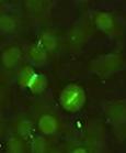 DIAGNOSTYKA LABORATORYJNA AUTOPRZECIWCIAŁ... [ 107 ] Ryc. 24. Most międzykomórkowy Ryc. 25. Chromosome coat Źródło: Chan E K L, Damoiseaux J, Carballo O G et al.