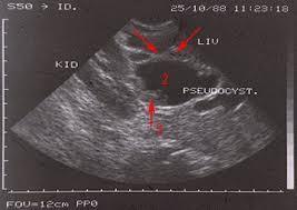 Metody obrazowania Obrazowanie nieelektromagnetyczne Ultrasonografia Metody echa Metody dopplerowskie Badanie USG u 6.letniego dziecka.