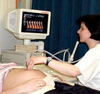 Metody dopplerowskie Zgodnie z zasadą Dopplera (jako zjawisko) jeśli obiekt zbliża się do przetwornika, to częstotliwość fali odbitej zwiększa się i odwrotnie,