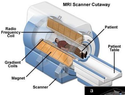 MRI