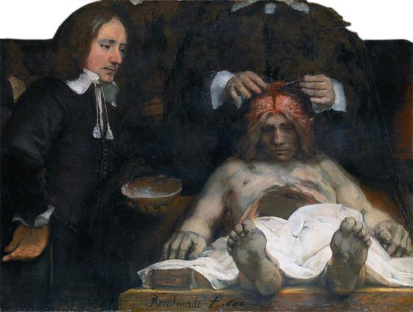 Mało kto wie, że twórca najsłynniejszej lekcji anatomii był autorem drugiego obrazu o podobnej tematyce.
