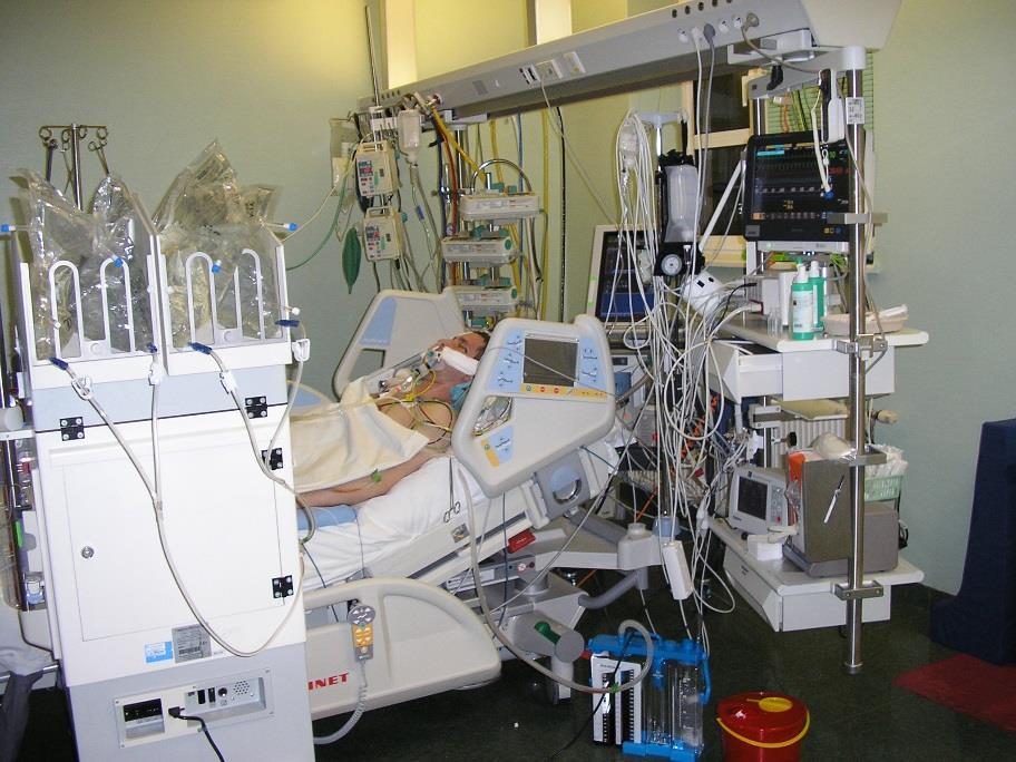 ECMO 31