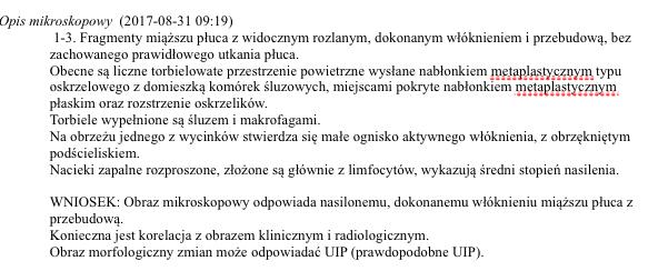 Wykonano kriobiopsję płuca Dzięki