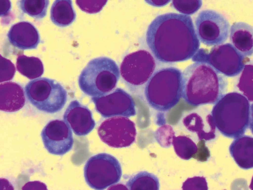 ), a analizy epidemiologiczne w programie EpiTools (17).