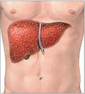 Przeszczepienie wątroby Wskazania do transplantacji wątroby: ostra