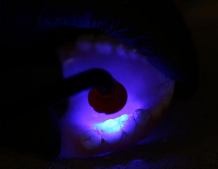 16. Cold laser opcja zimnego lasera ipad Fot. 17.