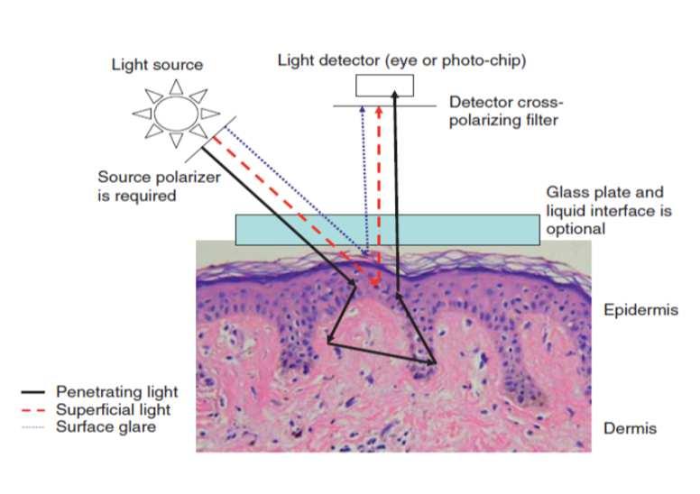 Badanie dermatoskopem ze światłem spolaryzowanym Atlas of Dermatoscopy A.