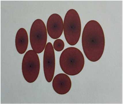 Wzorzec zatokowy (homogeneous pattern)