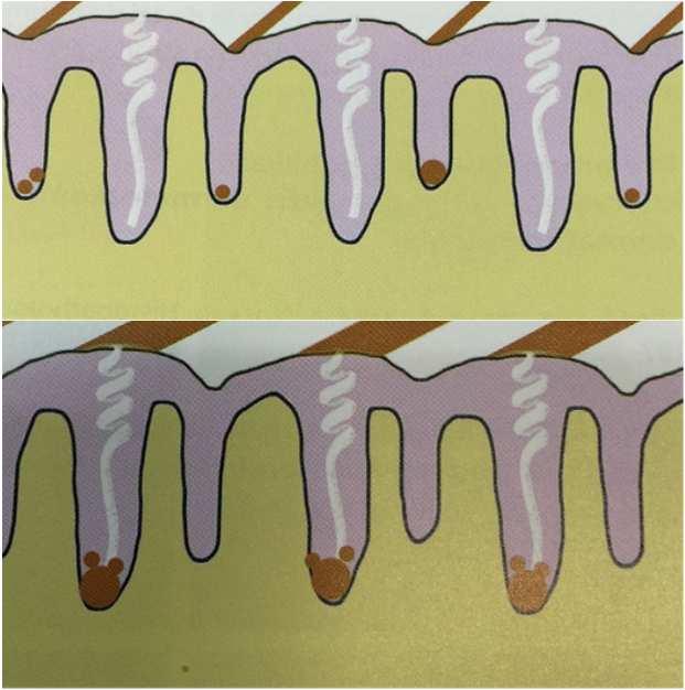 Exp Derm.