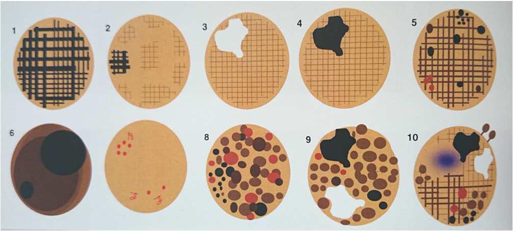 Pattern anaysis Atlas of dermoscopy2 nded.
