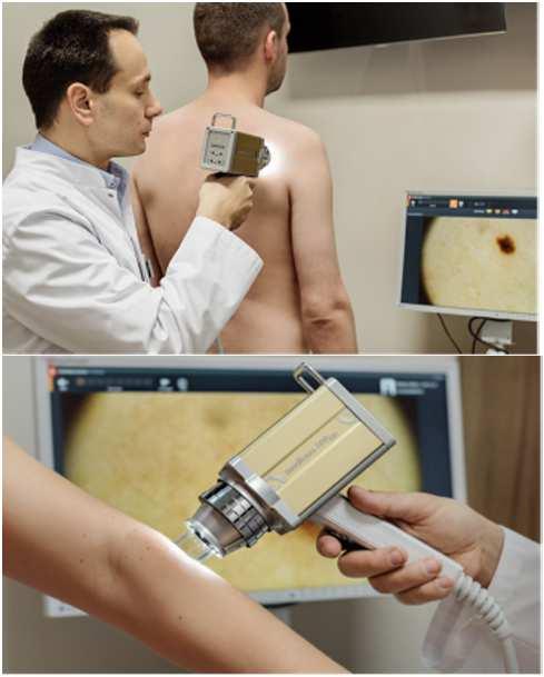 wideodermatoskop Zdjęcia własne