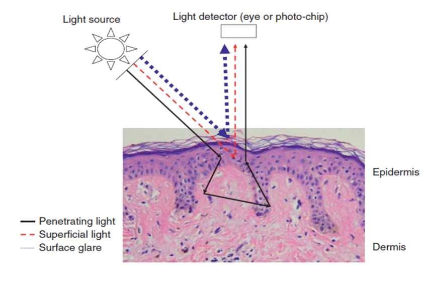 Badanie okiem nieuzbrojonym Atlas of Dermatoscopy A. Marghoob, J. Malvehy, R.