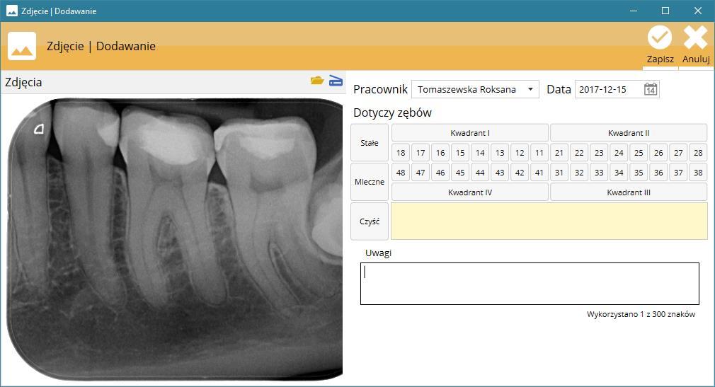 graficzne (jpg, png, gif itd.) jak i pliki w formacie DICOM (rvg i rvt), pochodzące z aparatów RVG firm Kodak, Gendex itd. W zakładce tej możliwe jest ponadto pobranie zdjęć ze skanera. Uwaga!