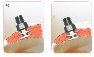 The engineering trials involved, among other methods, the Finite Element Method and an application of software for modelling and 3D visualization.