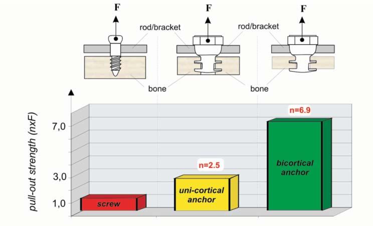 Examples of FEM results: a) the sum of dislocations in the configuration: stabilizerbone, b) the stress pattern in a single implant according to von Mises Ryc. 5.