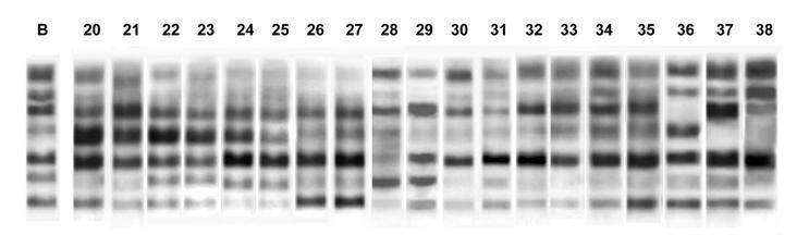 inhibitorów trypsyny