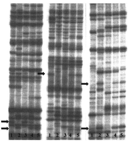 Rys. 2. Profile DNA linii: karłowej o genotypie ds1ds1 (5) i kontrolnej o genotypie Ds1Ds1 (3) ich potomstwa F 2 (4) oraz form rodzicielskich populacji mapującej: DS2 (1) i RXL10 (2).
