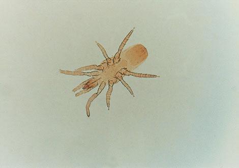 (mniejsze przestwory miêdzyglebowe) Wielkoœæ cia³a 0,8 1,5 mm, owalne (Ryc. 3) 0,25 0,5 mm, wyd³u one (Ryc.