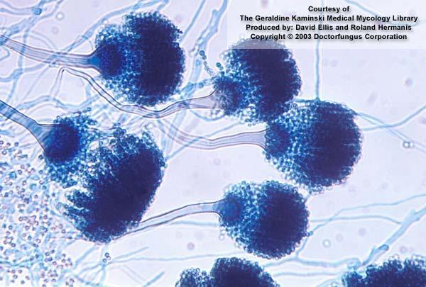 Mucor racemous Aspergillus fumigatus Ascomycetes workowce Grzyby