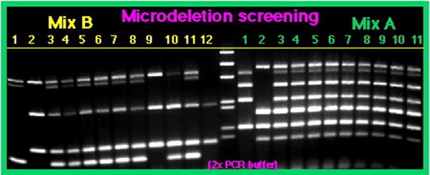 Asymetryczny PCR w reakcji używany jest jeden starter lub dwa w nierównych stężeniach amplifikacji ulega tylko jedna nić Stosowany np.
