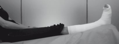 W przypadku wystąpienia opuchlizny może dojść do nadmiernego uciskania palców. Bij armletsel: Houd uw arm hoog. Overdag in een lus en 's nachts op een kussen.
