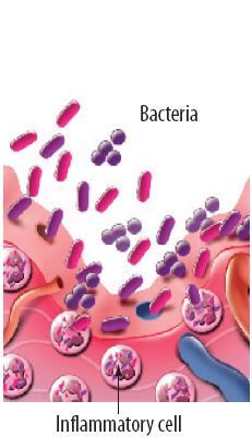 Normal epithelium
