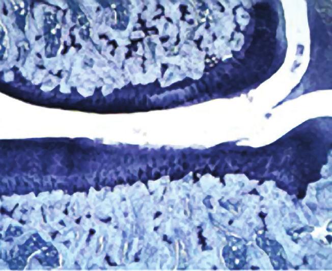 makrofagi stymulowane przez IL-1ß 9^ hamuje katabolizm tkanki chrzęstnej 4^ chroni chrząstkę w modelu rozerwania łąkotki (rysunek 4) 10 * łagodzi ból u dużych zwierząt, u których naturalnie występuje