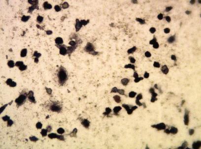 POLIMERY 2015, 60, nr9 557 a) b) c) Rys. 6. Obrazy powierzchni wytworzonych poli(wêglanouretanów) po 72 h hodowli fibroblastów: a), b) HM2, c) HM3 Fig. 6. Images of the surface of the obtained polycarbonate after 72 h fibroblasts culture: a), b) HM2, c) HM3 a) b) c) Rys.