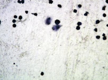 h hodowli ludzkich monocytów linii THP-1: a), b) HM2, c) HM3 Fig. 7.