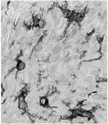 cytotoksyczne (T C ) limfocyty T regulatorowe (T reg ) = supresyjne (T S ) Limfocyty NK (natural killers)