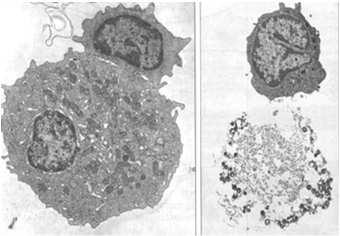 Plazmocyty produkują przeciwciała (immunoglobuliny) skierowane przeciw antygenowi, który wywołał