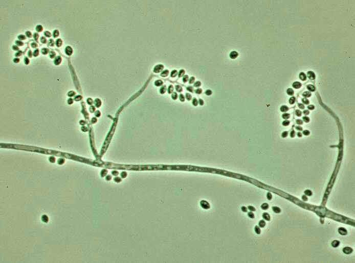 BIOPESTYCYDY MIKROBIOLOGICZNE Biopestycydy mikrobiologiczne zawierają żywe mikroorganizmy, głównie bakterie lub grzyby, które