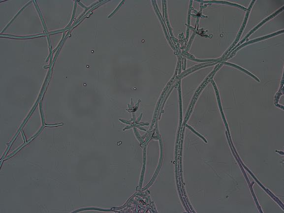 Trichoderma sp.