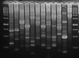rodzaju Pseudomonas oraz bakterii wiążących azot atmosferyczny różniły się od