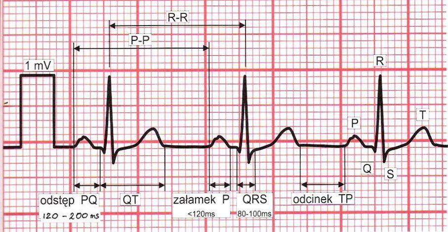 EKG Najważniejsze narzędzie w diagnostyce kanałopatii Szukając kanałopatii w EKG zwracamy uwagę na: - ocenę zaburzeń rytmu -
