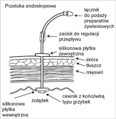 PEG