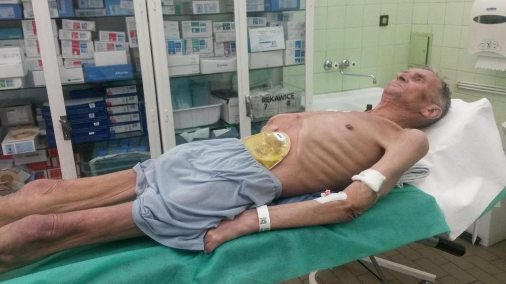 Głodzenie stresowe: szybka mobilizacja białek z mięśni, skóry, kości na rzecz wykorzystania