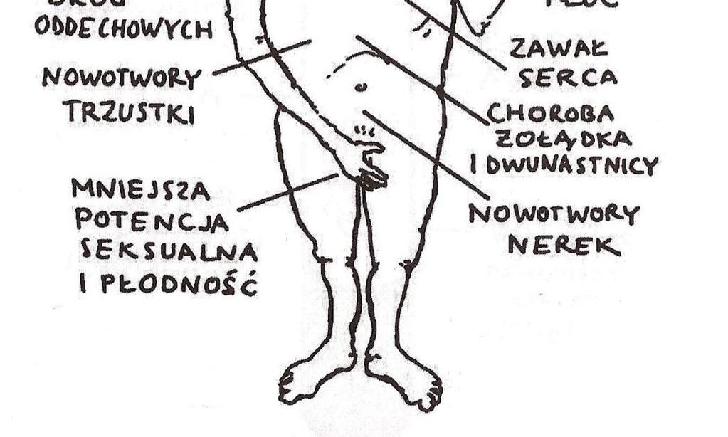 przewlekłą obturacyjną chorobę płuc, astmę oskrzelową, gruźlicę, choroby układu krążenia - chorobę niedokrwienną serca, zawał mięśnia sercowego, miażdżycę zarostową kończyn dolnych, nadciśnienie