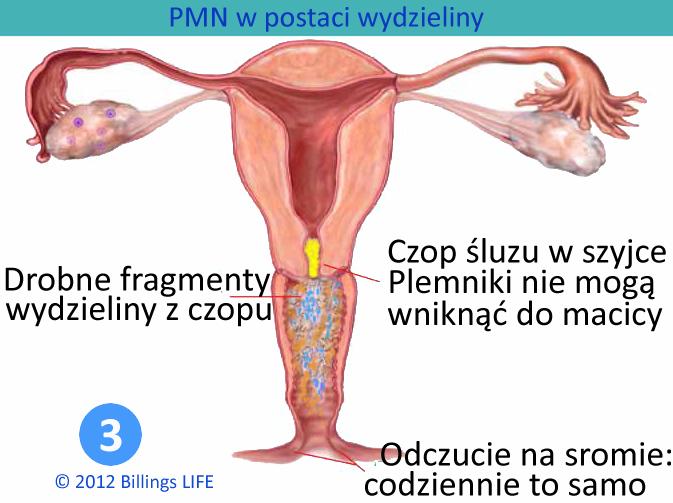 srom pozostaje suchy. Również w obserwacji wzrokowej nie pojawia się NIC. Szyjka jest w tym czasie zaczopowana gęstym zbitym czopem śluzowym.