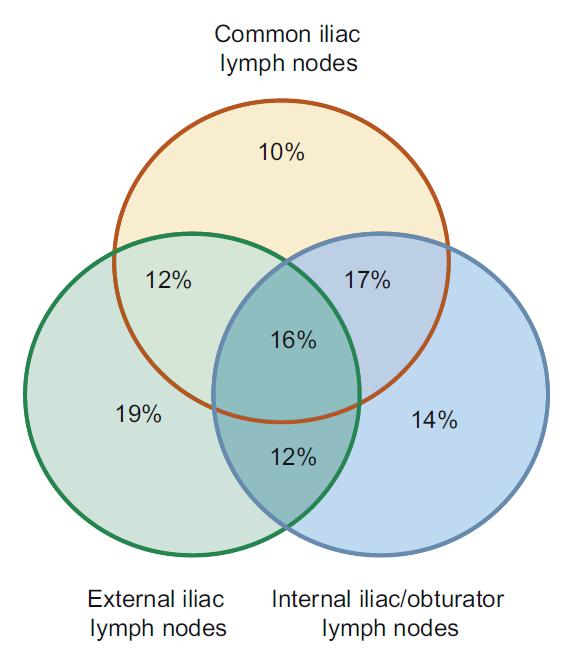 Diagram Venn a - odsetek zajętych węzłów chłonnych w poszczególnych lokalizacjach anatomicznych u pacjentów, u których obserwowano wznowę